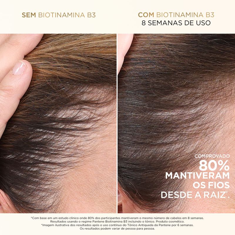 FRIDA_PANTENE_SI04_BEFORE_-_AFTER.jpg