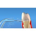 Waterpik - Bico Jato Clássico - WP60/65/70/72/75 - 02 unidades