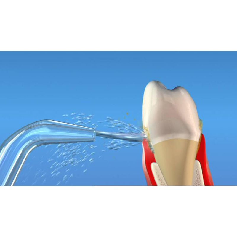 Waterpik - Bico Jato Clássico - WP60/65/70/72/75 - 02 unidades