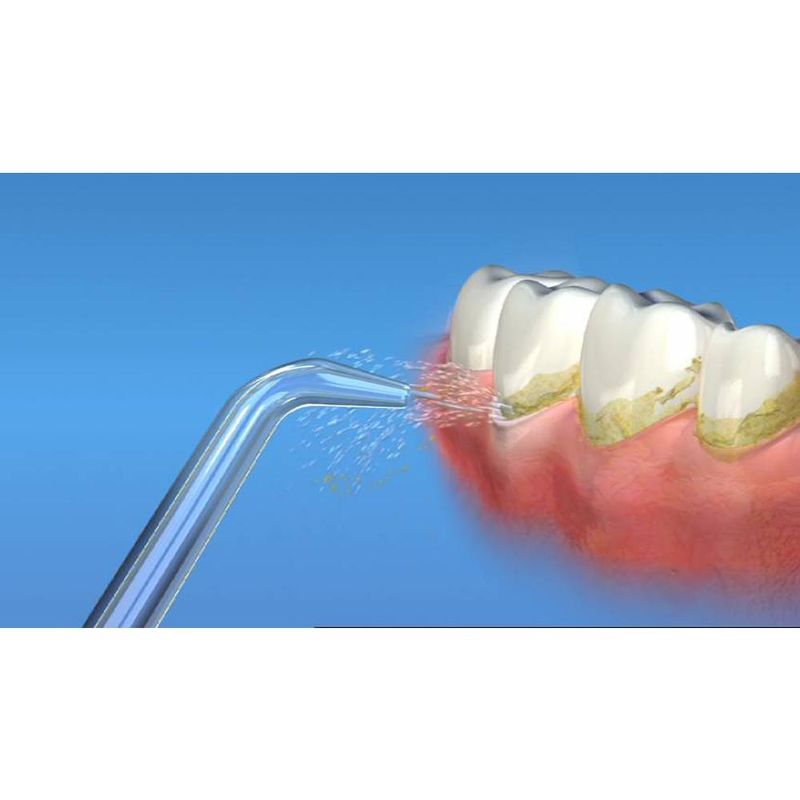 Waterpik - Bico Jato Clássico - WP60/65/70/72/75 - 02 unidades