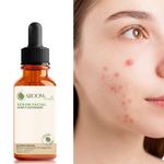 Fórmula Exclusiva - Blend de Óleos Faciais para Acne e Oleosidade - 30ml