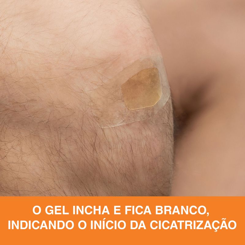 7891040295340-Curativo-Cicatrizacao-Avancada--6-
