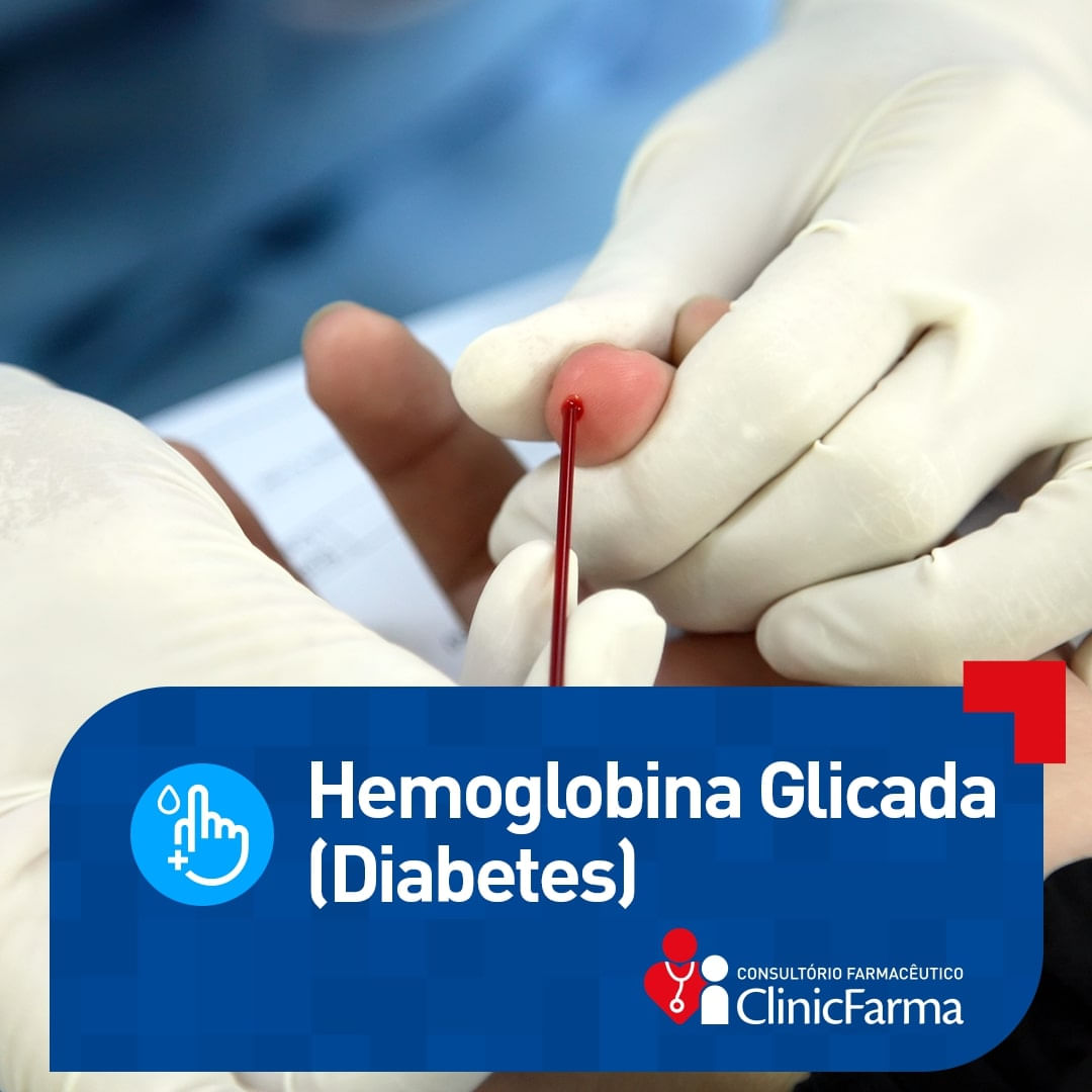 Brazil product data sample: Exame H Glicada Medlev